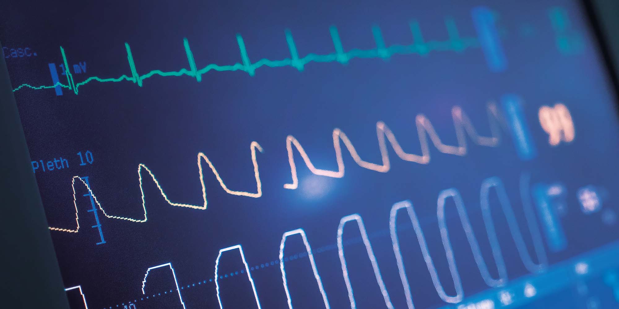 ECG Simulators Calibration